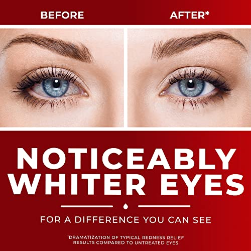 Clear Eyes Maximum Redness Eye Relief Eye Drops, 1 Fl Oz (Pack of 3) - Image 3