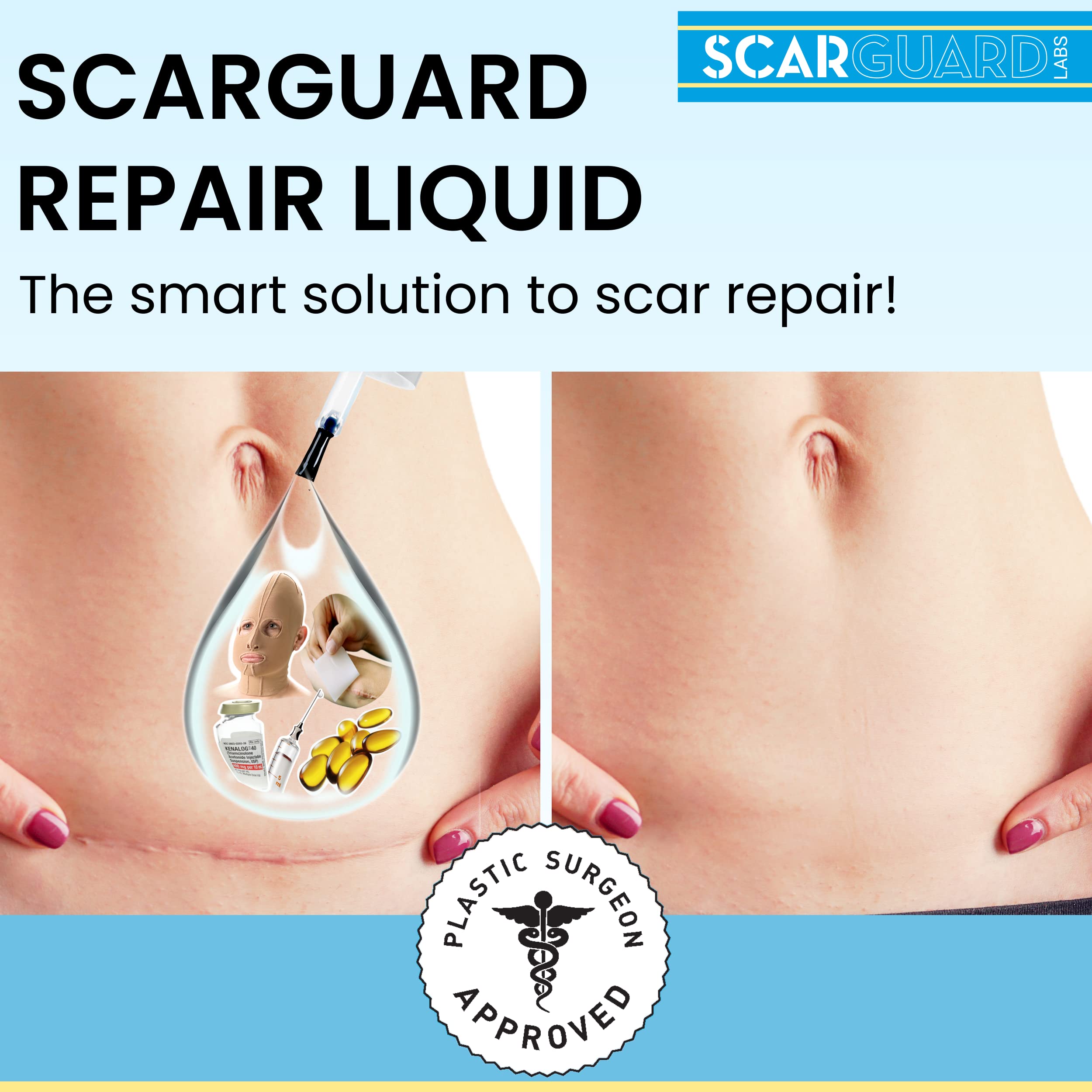 Scarguard - Invisible Brush-On Silicone Sheet with Vitamin E - Scar Removal for Keloids, B - Image 2