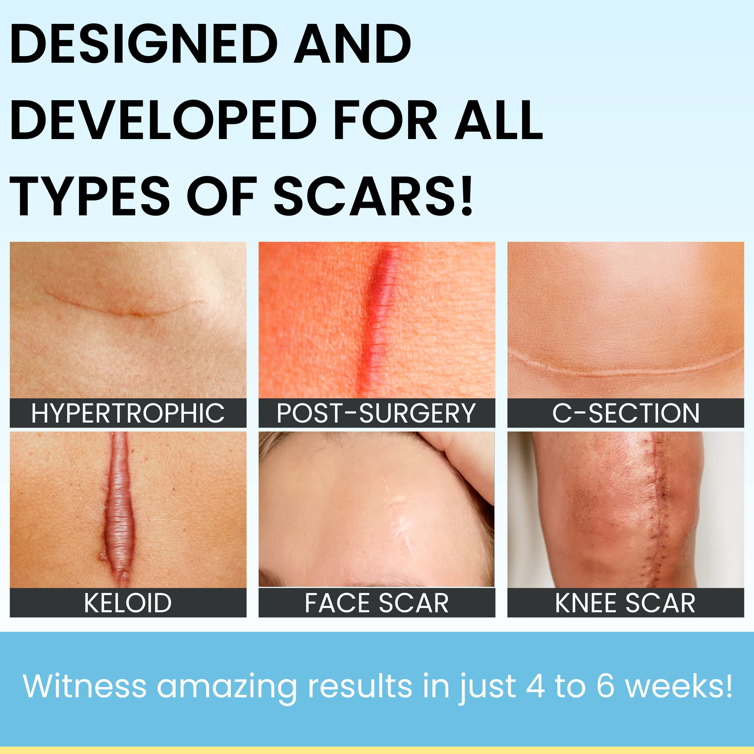 Scarguard - Invisible Brush-On Silicone Sheet with Vitamin E - Scar Removal for Keloids, B - Image 3