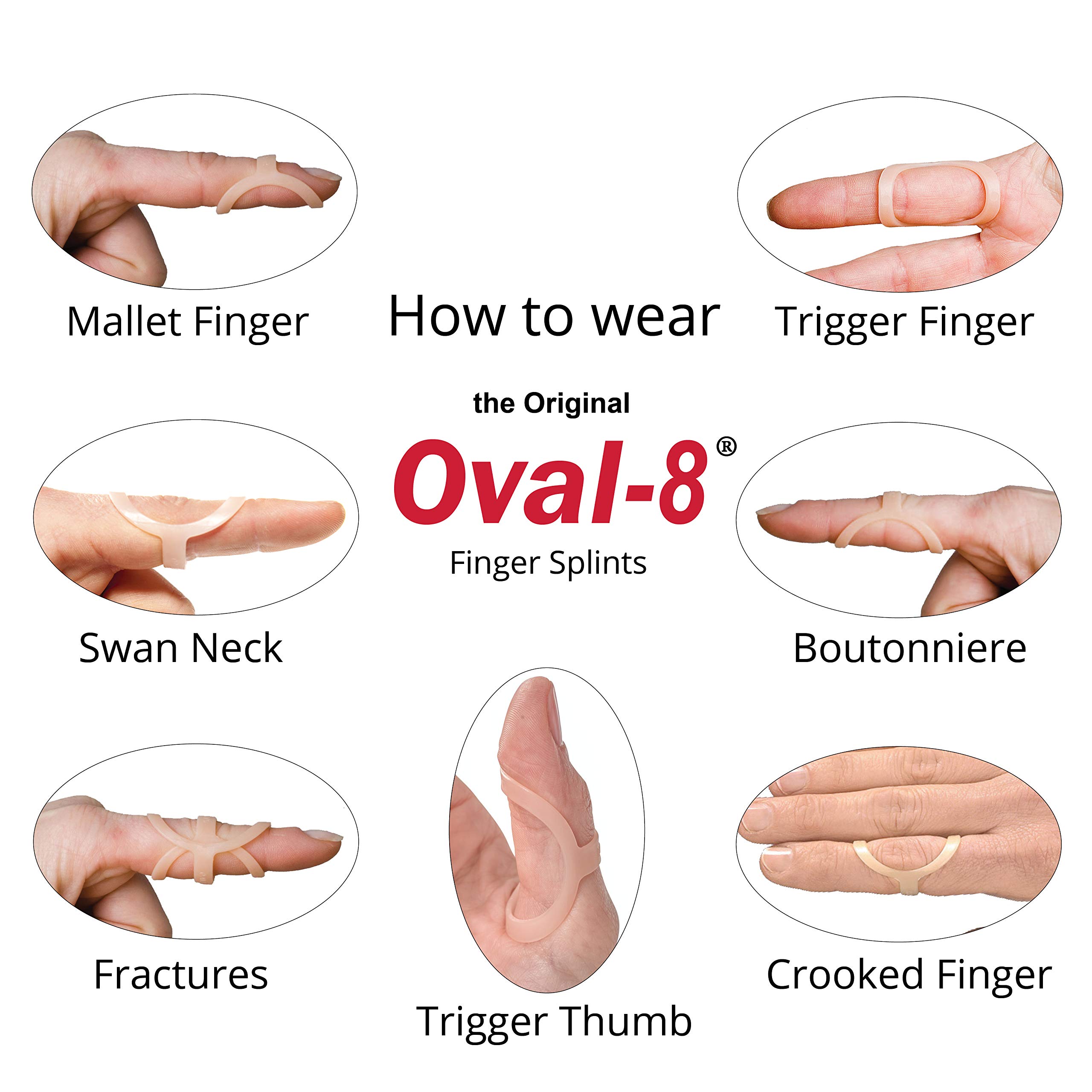 3-Point Products Oval-8 Finger Splints, Support and Protection for Arthritis, Trigger Fing - Image 2