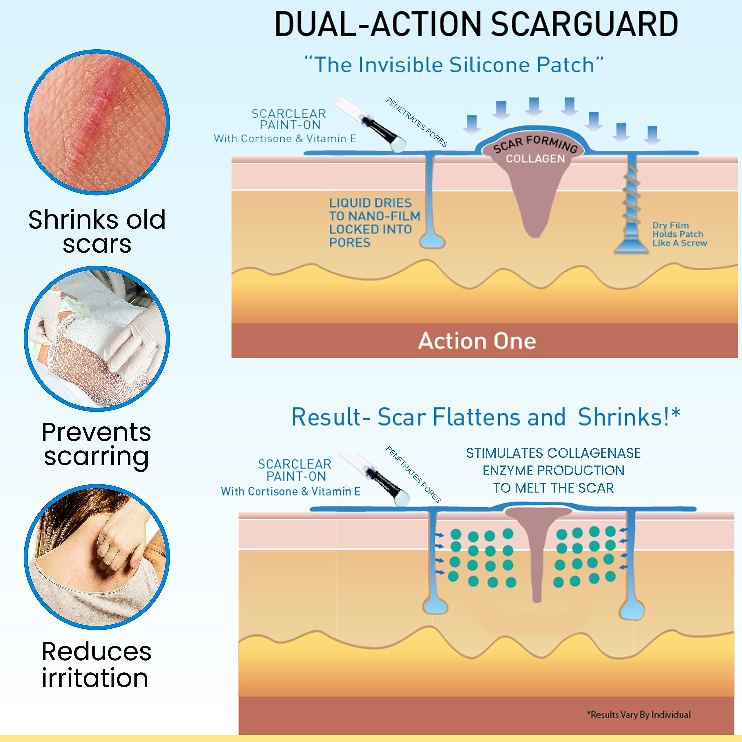 Scarguard - Invisible Brush-On Silicone Sheet with Vitamin E - Scar Removal for Keloids, B - Image 7