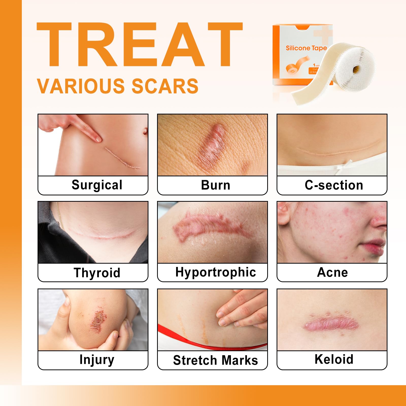 Silicone Scar Sheets (1" x 60"Roll), Soft Silicone Scar Tape for Scars Removal, Reusable E - Image 2