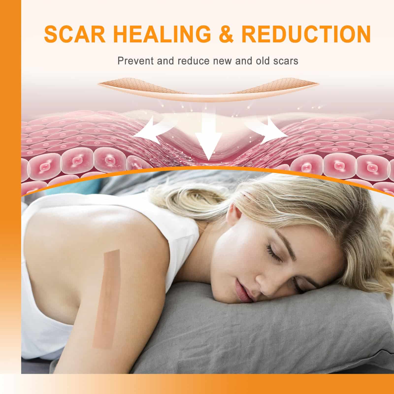 Silicone Scar Sheets (1" x 60"Roll), Soft Silicone Scar Tape for Scars Removal, Reusable E - Image 4